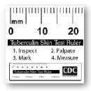 FREE Mantoux Tuberculin Skin Testing Ruler